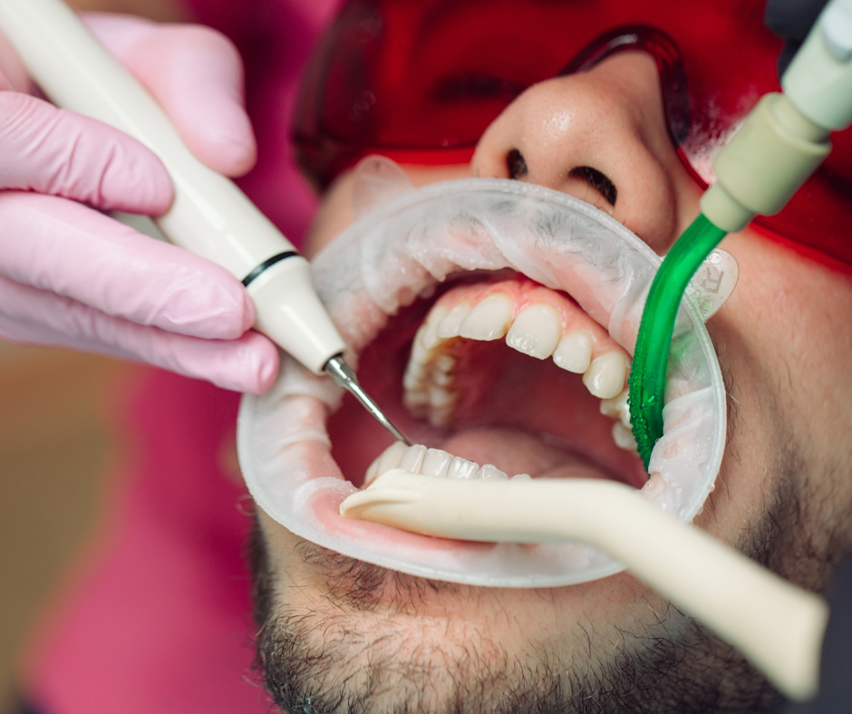 What should you expect during a teeth cleaning session for a comfortable and effective experience