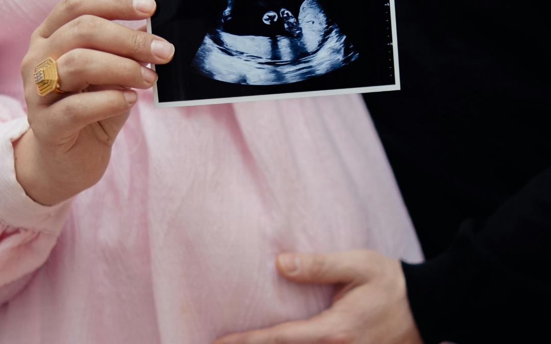 4D baby scan